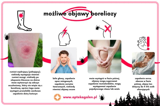 Borelioza objawy psychiczne: jak choroba wpływa na zdrowie psychiczne i co robić Borelioza objawy psychiczne: jak choroba wpływa na zdrowie psychiczne i co robić
