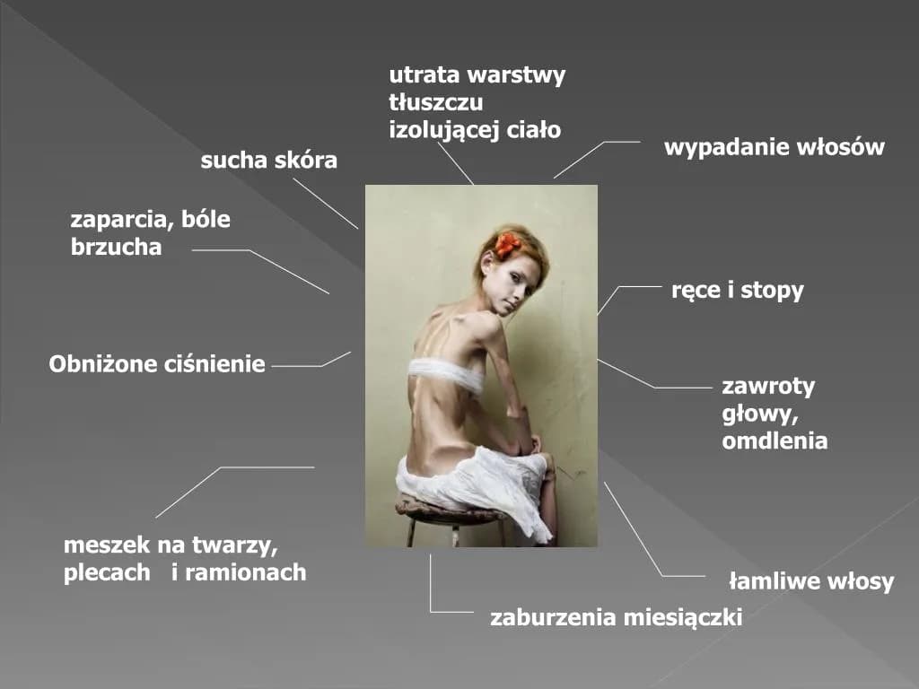 Anoreksja objawy psychiczne: Jak niska samoocena wpływa na zdrowie? Anoreksja objawy psychiczne: Jak niska samoocena wpływa na zdrowie?